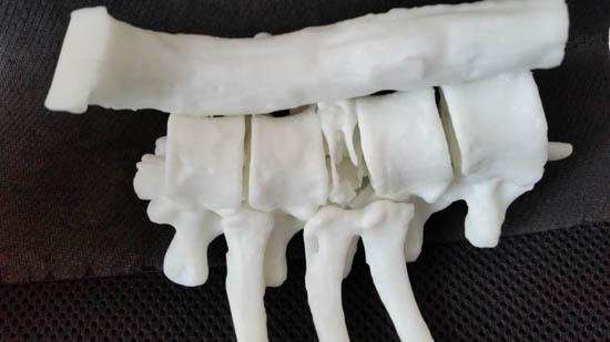 贵州医科大学附属医院3D打印人体器官模型 为医患带来希望