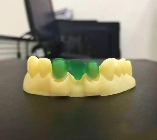 WELLS成功开发出专属齿科3D打印机  打造新一代数字化齿科打印专家