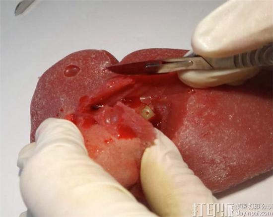 Lazarus 3D开发出可进行真实手术操作的3D打印模型 Lazarus 3D开发出可进行真实手术操作的3D打印模型