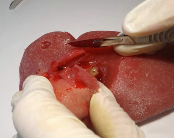 Lazarus 3D开发出可进行真实手术操作的3D打印模型