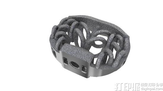 Camber Spine公司的3D打印体内融合脊柱植入物获得FDA批准