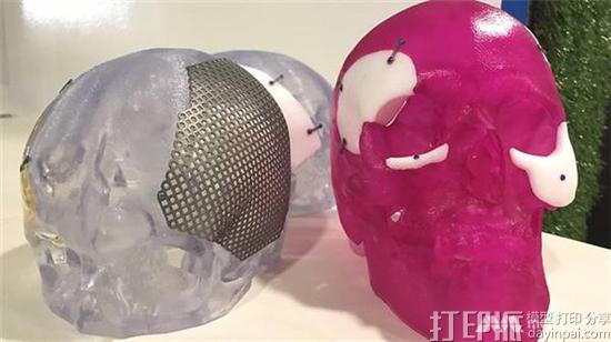 Anatomics与多家新加坡机构合作 以开发新的3D打印医疗设备 Anatomics与多家新加坡机构合作 以开发新的3D打印医疗设备