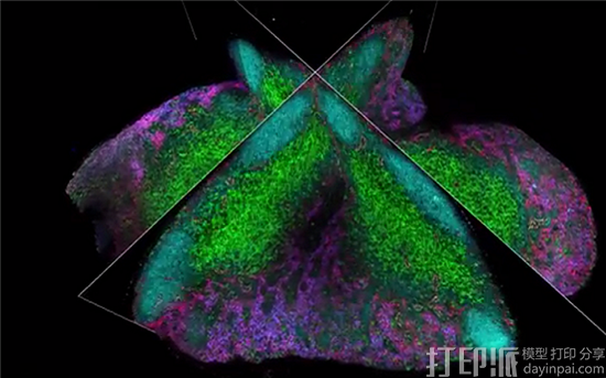研究人员开发新的更准确的显示肿瘤细胞的3D成像技术Ce3D 研究人员开发新的更准确的显示肿瘤细胞的3D成像技术Ce3D