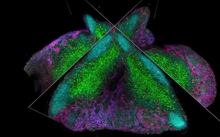 研究人员开发新的更准确的显示肿瘤细胞的3D成像技术Ce3D 