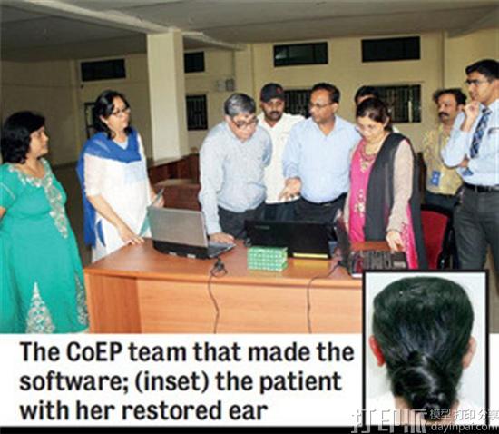医疗团队为一名印度女性快速制造出3D打印耳朵假体植入物 