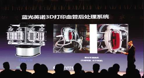 四川蓝光英诺解决3D打印人体器官难题，中国技术让世界瞩目