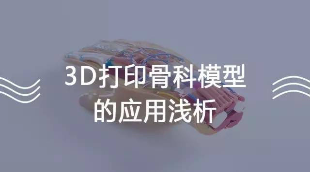 浅析：3D打印骨科模型的应用