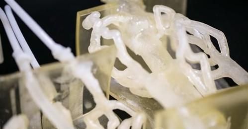 生物3D打印“点石成金” 脂肪或将变身救命法宝