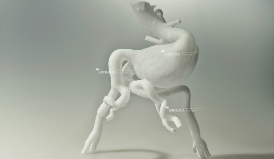 金玺银杏将3d打印运用医学手术 助力多名患者恢复健康