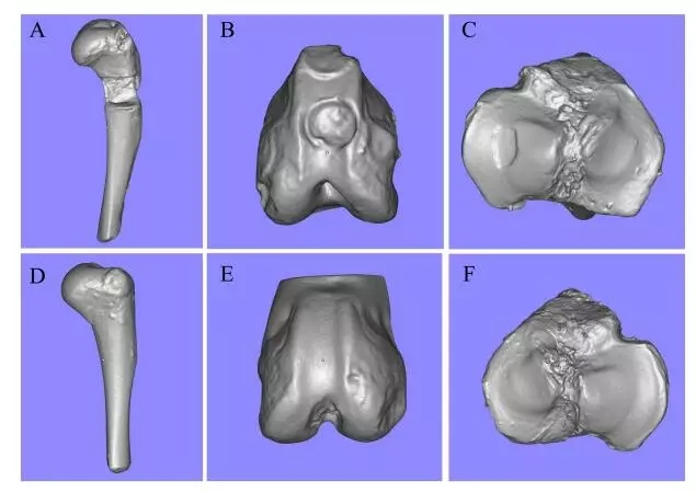 3D扫描技术登上综合性学术期刊，或将改变未来骨科手术