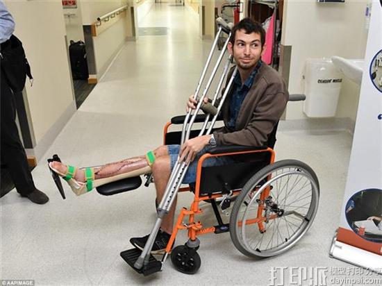 医院为澳洲小伙植入了3D打印胫骨支架 助其逃脱截肢厄运