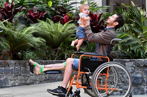 医院为澳洲小伙植入了3D打印胫骨支架 助其逃脱截肢厄运