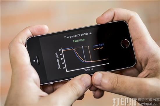 研究人员开发出3D打印的智能手机工具 可帮助诊断脑震荡