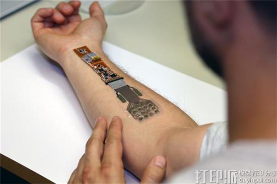 芬兰人员开发出3D打印绷带 可监测伤口情况 还能无线发送监控数据