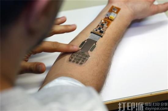 芬兰人员开发出3D打印绷带 可监测伤口情况 还能无线发送监控数据