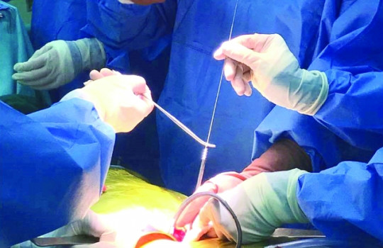 南方医科大学深圳医院用3D打印护航  完成高难度骨科手术