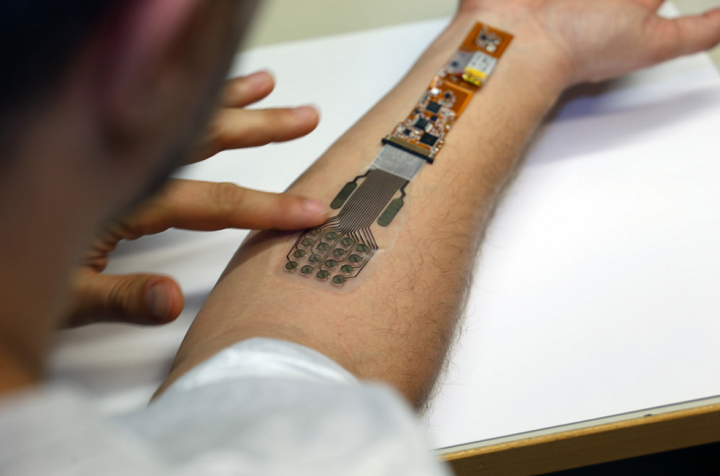 芬兰人员开发出3D打印绷带 可监测伤口情况 还能无线发送监控数据