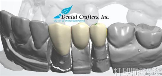 齿科医疗服务商Dental Crafters宣布将全面应用3D打印技术 齿科医疗服务商Dental Crafters宣布将全面应用3D打印技术