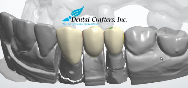 齿科医疗服务商Dental Crafters宣布将全面应用3D打印技术