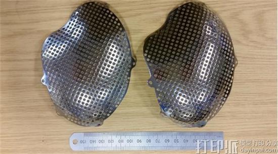 雷尼绍采用Rosler技术将3D打印钛颅骨植入物的后处理时间缩短了80％