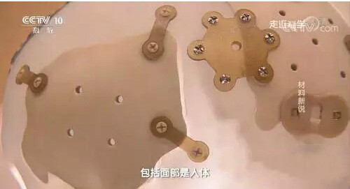 详解：3D打印PEEK与钛合金做为颅骨修补材料优劣对比