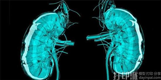澳洲默多克儿童研究所安装本国首台生物3D打印机 以研究肾脏疾病