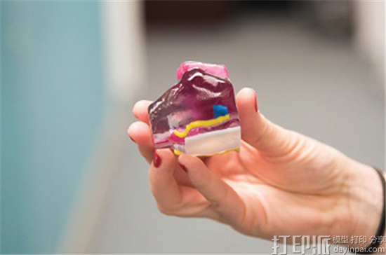 纽约工作室与医院合作将全彩3D打印前列腺肿瘤模型用于临床试验
