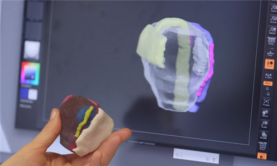 纽约工作室与医院合作将全彩3D打印前列腺肿瘤模型用于临床试验