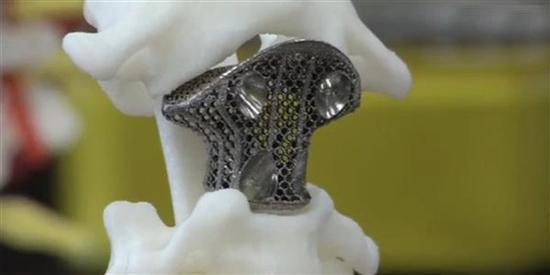 专家建言：3D打印技术可应用到外科仿真训练当中