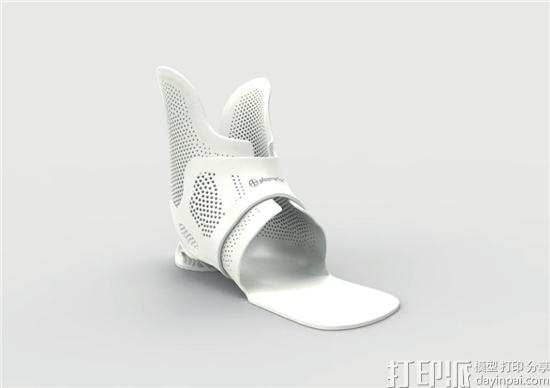 对比传统矫形器制作与3D打印矫形器的区别