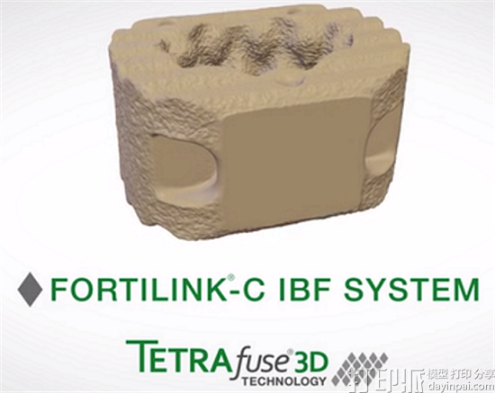 RTI Surgical将推出世界上首款用于融合术的3D打印聚合物植入物材料