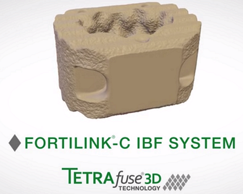 RTI Surgical将推出世界上首款用于融合术的3D打印聚合物植入物材料