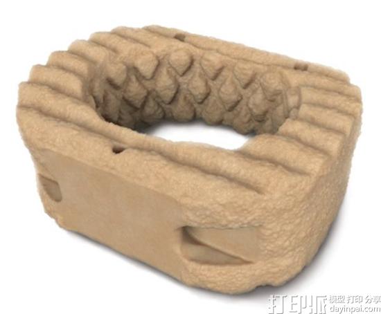 RTI Surgical将推出用于脊柱手术的新型3D打印植入物系统