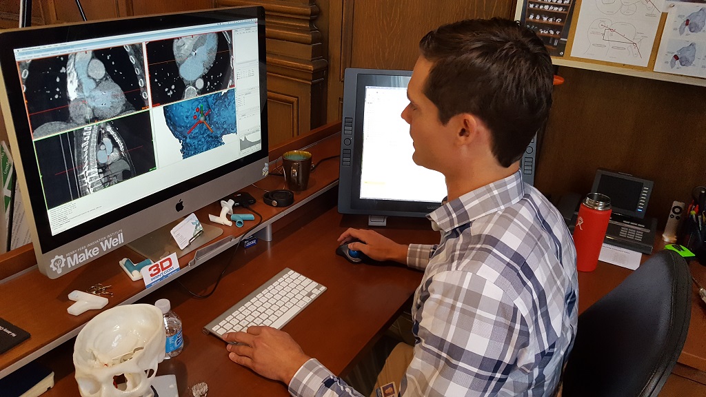 Materialise携手亨利福特健康系统推进用于心脏手术的3D建模研究