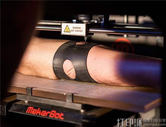 法国三名学生发明出3D打印纹身机 每秒150针 几分钟完成图案