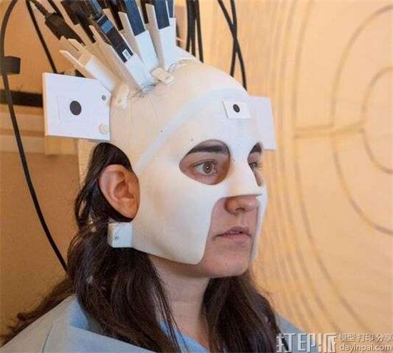 科学家开发出3D打印穿戴式大脑扫描仪原型 比现有MEG系统灵敏4倍
