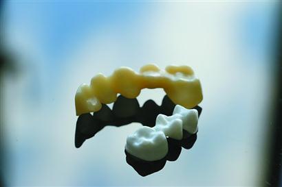 上海应用技术大学创新陶瓷材料3D打印 最大应用于牙齿打印