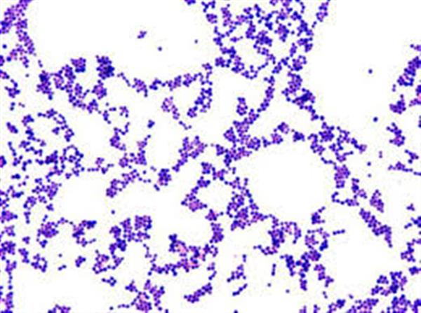罗彻斯特大学获600万美元资助 将用3D打印技术研究骨骼感染