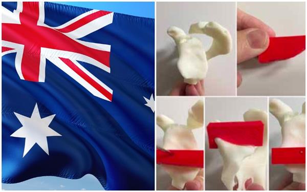 澳大利亚药物管理局计划对定制3D打印医疗设备的规定进行修改