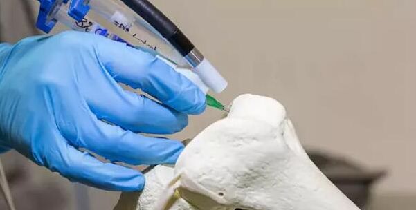 阜新市首次将3D打印技术应用到医疗领域 