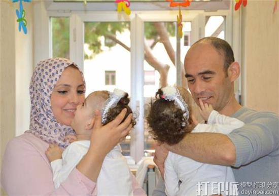 意大利儿科医生使用3D打印模型成功完成连体双胞胎分离手术 意大利儿科医生使用3D打印模型成功完成连体双胞胎分离手术