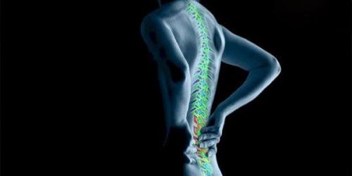 3D打印技术在神经调控领域的应用解析