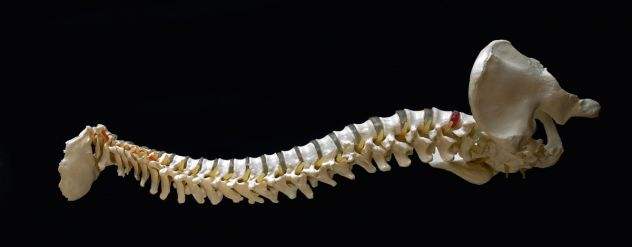  青岛一医院借助数字技术与3D打印技术成功完成一例颈胸段脊柱结核手术