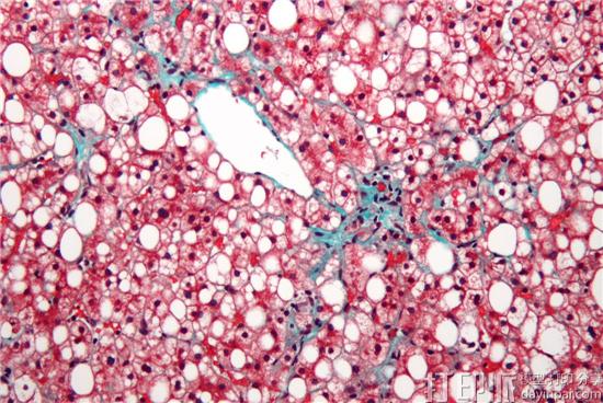 Organovo与Viscient Biosciences合作进行用于肝病治疗的3D打印研究 Organovo与Viscient Biosciences合作进行用于肝病治疗的3D打印研究