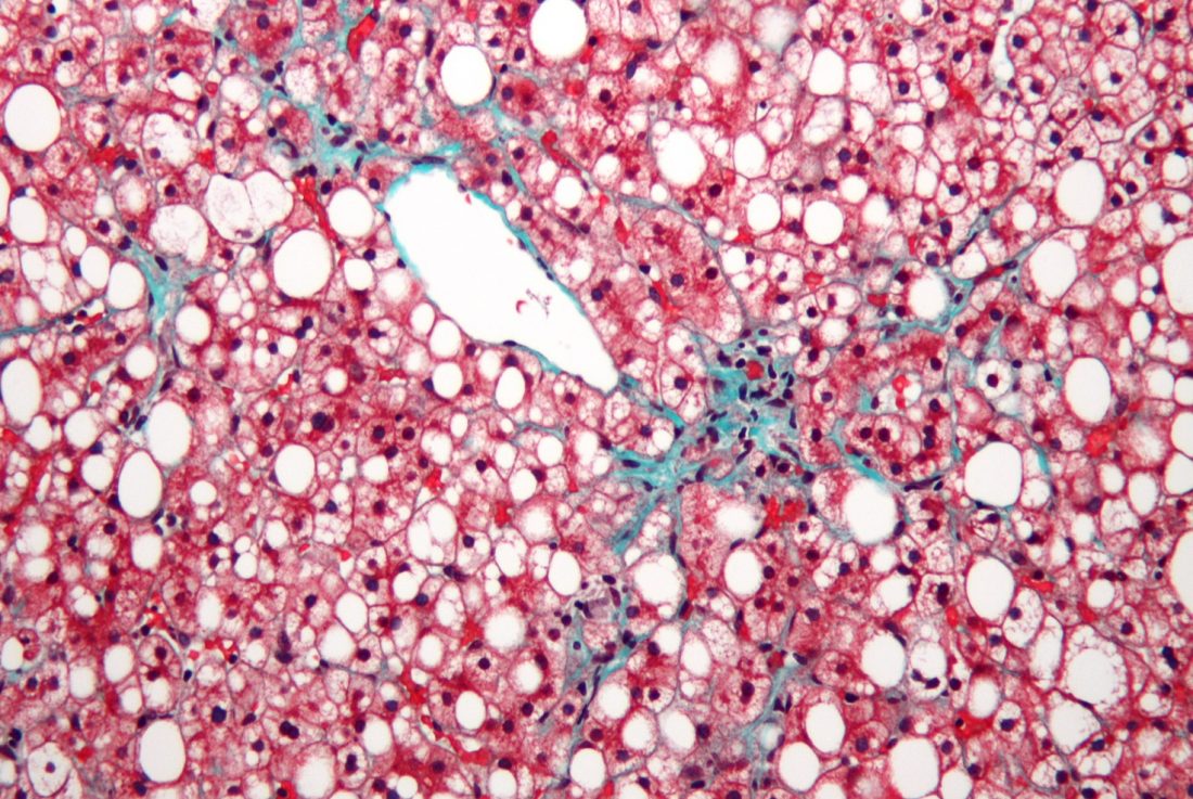Organovo与Viscient Biosciences合作进行用于肝病治疗的3D打印研究