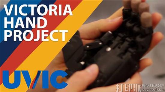 研究人员开发出治疗儿童脊柱侧弯和马蹄内翻足的3D打印支架 研究人员开发出治疗儿童脊柱侧弯和马蹄内翻足的3D打印支架