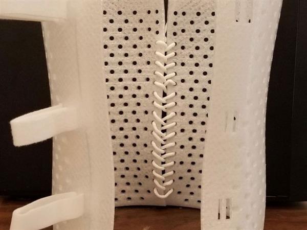 研究人员开发出治疗儿童脊柱侧弯和马蹄内翻足的3D打印支架