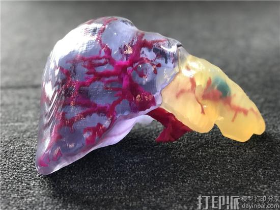 3D打印技术在临床医学教学中的应用