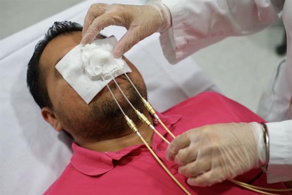 西班牙研究人员开发出可改善皮肤癌放疗治疗的3D打印保护装置