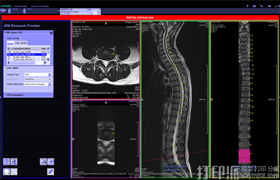 Materialise宣布与西门子合作推广3D打印解剖模型软件 Materialise宣布与西门子合作推广3D打印解剖模型软件